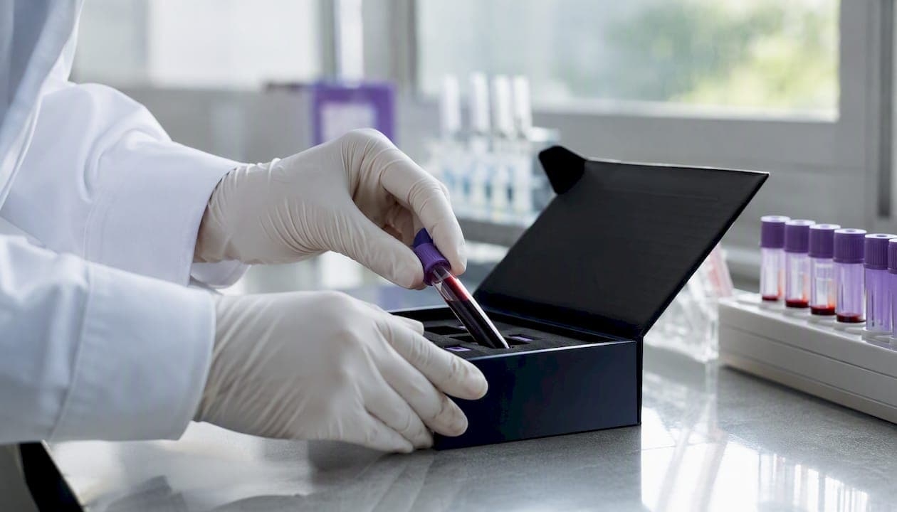 Sickle Cell Carrier Testing for Family Planning